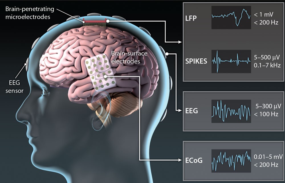 Brain-machine interfaces are slowly becoming a reality and no longer sci fi